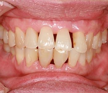 effective diagnosis and treatment of periodontal disease from Dentist in Central HK
