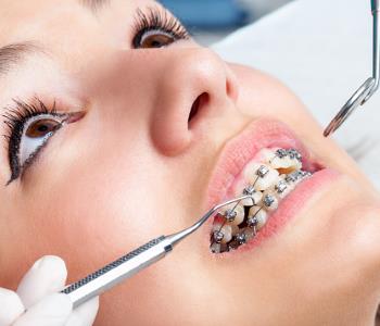 Effective teeth alignment solutions from Dentist in Central HK