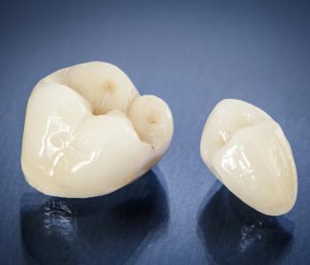 Consider the benefits of a crown from your dentist in Hong Kong if you have a broken tooth